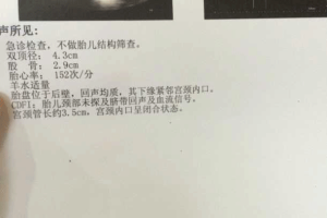 胎盘低置