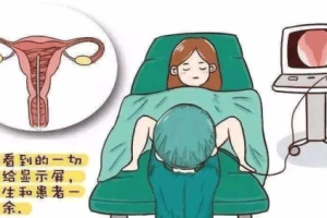 宫腔分离