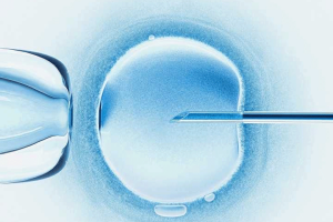 第一代试管婴儿(IVF)